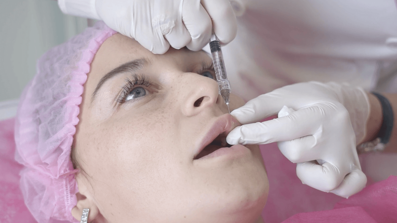curso de dermal filler profesional