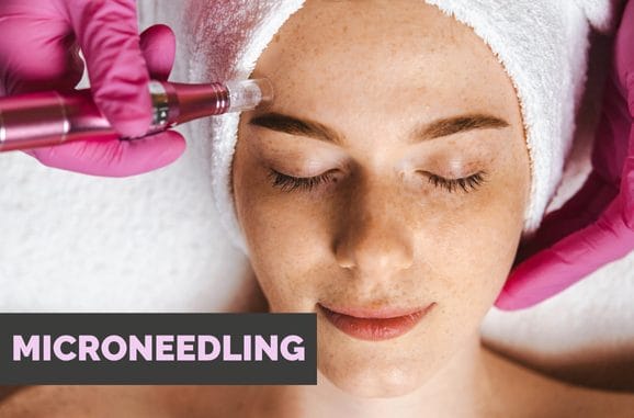 Microneedling ampoules for specific skin concerns